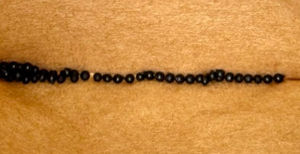 Massonia pustulata 5 Pieces Seeds