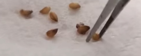 Myrmephytum Arfakianum 6 Pieces Seeds