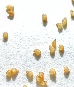 Gibbaeum pilosulum 10 Pieces Seeds